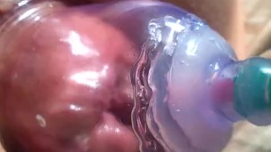 Vacuum anal bloom close up